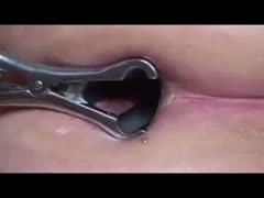 Using metal speculum to stretch my girlfriend's restricted anus